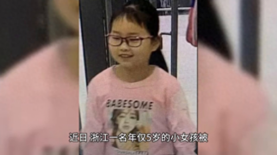 浙江一5歲女孩確診長發公主綜合征