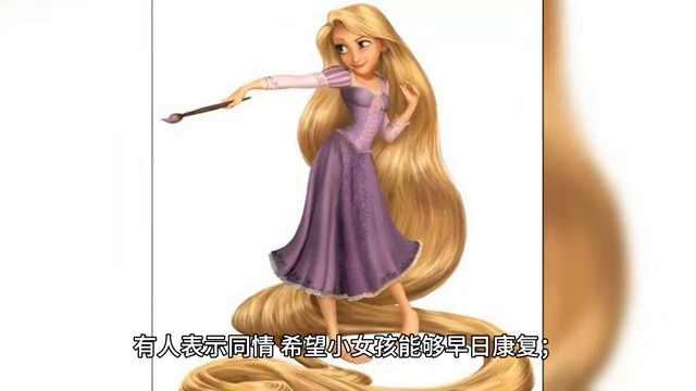 浙江一5歲女孩確診長發公主綜合征